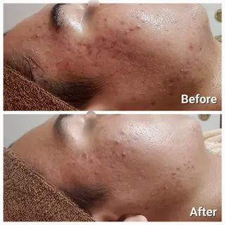 オーダーメイドハーブ ピーリングOPEN✨のエステ・リラクイメージ