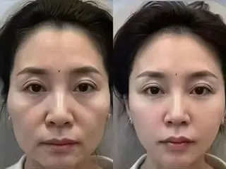 マツエク・マツパ aliaハイフ&水光ジェットサロン所属・aliaハーブ水光店 エステティシャン募集のエステ・リラクイメージ