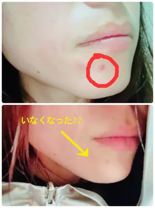 ヨサパークルル 進化系よもぎ蒸しのエステ・リラクイメージ