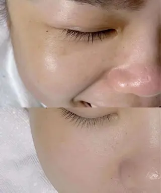 マツエク・マツパ aliaハイフ&水光ジェットサロン所属・aliaハーブ水光店 エステティシャン募集のエステ・リラクイメージ