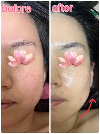 CHURA （美ら）のエステ・リラクイメージ