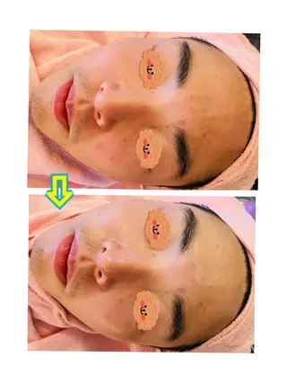 ビューティアス〜Beautyus〜所属・山田 美夕紀のエステ・リラクイメージ