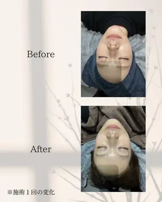 ハーブピーリング🌿 REVI/Ayanoのエステ・リラクイメージ