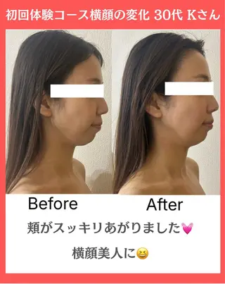 la lumie're (ラ リュミエール)所属・小顔サロン (ラ リュミエール)のエステ・リラクイメージ