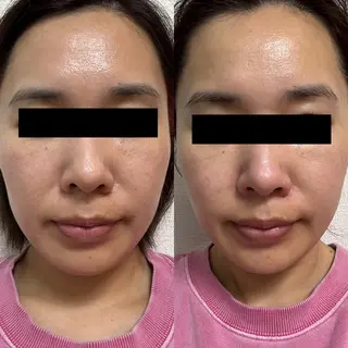 エステティックサロン Liente(リアンテ)所属・Hashimoto .のエステ・リラクイメージ