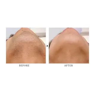 メンズ Puki Puki 脱毛サロンのエステ・リラクイメージ