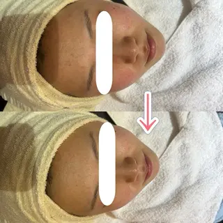 ビューティーサロン ソナタのエステ・リラクイメージ