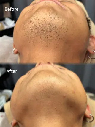 メンズ BELXIA所属・井櫻 玲香のエステ・リラクイメージ