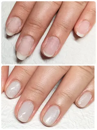ネイル 深爪矯正/爪育成ケア manie nailのネイルデザイン