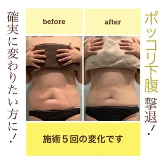 エステサロン JURISのエステ・リラクイメージ