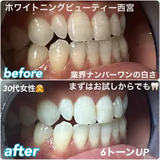 ホワイトニングビューティー西宮店所属・ホワイトニングビュー ティー西宮店のその他イメージ