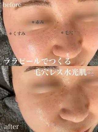 e-LABO こいずみのエステ・リラクイメージ