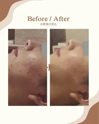 メンズ beauty salonnのエステ・リラクイメージ