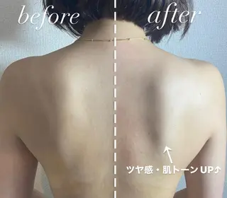 エピナス町田店 ブラジリアンワックスのエステ・リラクイメージ