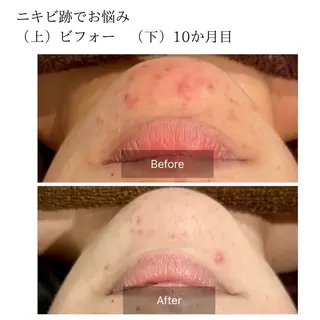 ハーブピーリング専門 エミルカ船橋のエステ・リラクイメージ