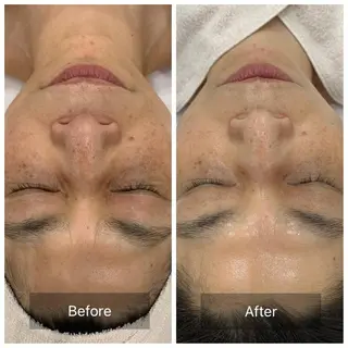 すっぴんたまご肌 平木さやかのエステ・リラクイメージ