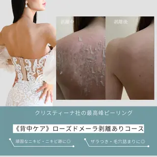 肌質改善ピーリング ✧BestBelleのエステ・リラクイメージ