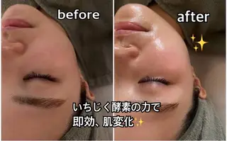 ReHerbウミカジテラス店所属・Reherb 🌿honokaのエステ・リラクイメージ