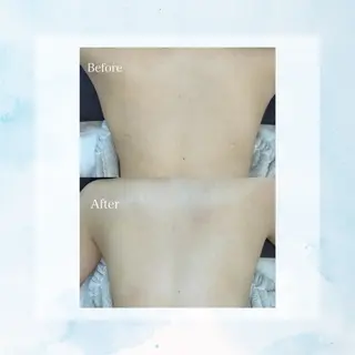 Belle beauty salon所属・Bellebeau tysalonのエステ・リラクイメージ