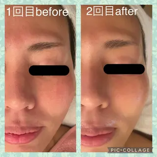 Serenity salonのエステ・リラクイメージ