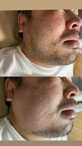 メンズ Epina 千葉店 【エピナ】のエステ・リラクイメージ