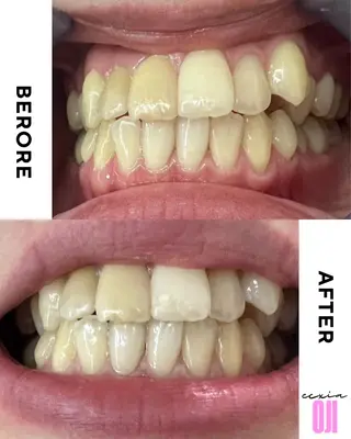 セルフホワイトニングサロン  エクシアホワイト 王寺店所属・エクシア王寺 NISHIKAWAのその他イメージ