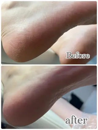 ❤︎MN❤︎ モンのエステ・リラクイメージ