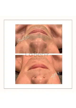 メンズ 脱毛/美肌【皮膚科看 護師経営】ラベニールのエステ・リラクイメージ