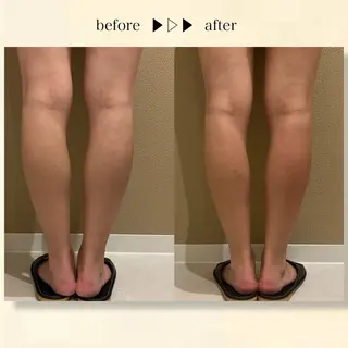 ☆痩身/小顔☆ ハイパーナイフexのエステ・リラクイメージ