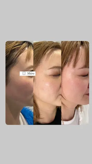 ［　］Shiro Meiのエステ・リラクイメージ