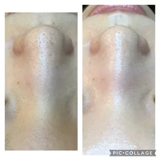 ニキビ/肌質改善専門 Snow skinのエステ・リラクイメージ