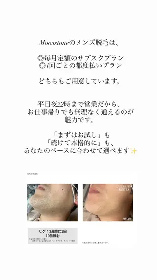 メンズ Beauty Salon Moonstone所属・Moonstone 男女•キッズ脱毛のエステ・リラクイメージ
