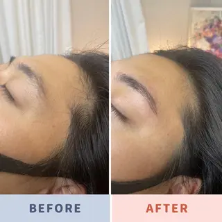 アイブロウ 筋膜/リンパ/深層/ スポーツ/アロマ/のエステ・リラクイメージ