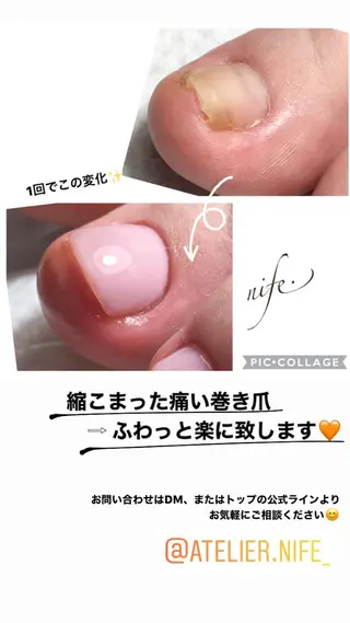 ネイル atelier nife.のネイルデザイン