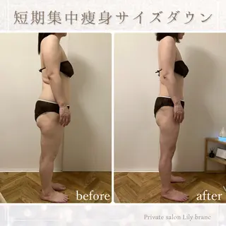 Lily branc 痩身/小顔/肌質改善のエステ・リラクイメージ