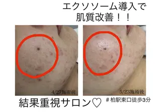 子宮矯正/腸揉み/ シュガーリング脱毛のエステ・リラクイメージ