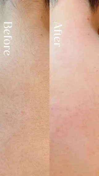 Hit. シュガーリング豊橋のエステ・リラクイメージ