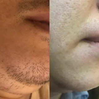 WAX＆光脱毛/瘦身 アイブロウ/牧野亞紀の眉毛・アイブロウイメージ