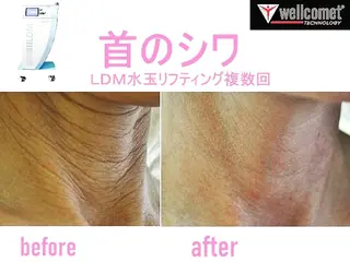 【ニキビ/肌管理】 salon varyのエステ・リラクイメージ