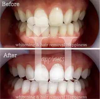 メンズ Happiness 広島並木通り店のその他イメージ