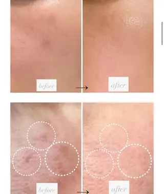 chouchou【シュシュ】所属・トータルボディケア chouchouのエステ・リラクイメージ