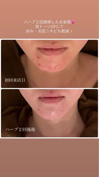 23beauty所属・武藤 那月のエステ・リラクイメージ