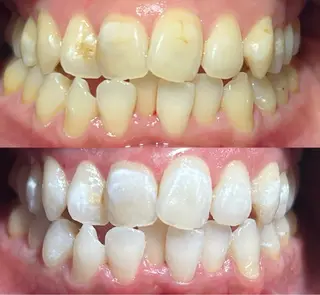 io teeth careのその他イメージ