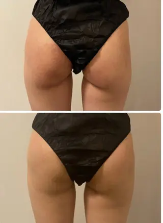 salon lady_goのマツエク・マツパデザイン