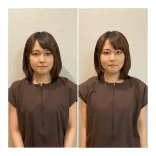 ショート 即小顔♥️美容鍼× ハーブピーリングのその他イメージ