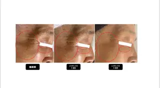 ヴィーナス ビューティーのエステ・リラクイメージ