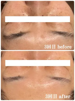 Folche所属・Folcheはません 森山のエステ・リラクイメージ