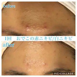 ショート カラー パーマ ヘアアレンジ メンズ キッズ ネイル マツエク・マツパ Ensor Clair所属・EnsorClair 代表　野口真央のエステ・リラクイメージ