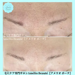 毛穴ケア専門サロン Amélio Beauté所属・毛穴ケア専門サロン アメリオボーテのその他イメージ
