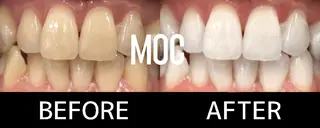 歯科提携セルフダック 宇都宮駒生店のエステ・リラクイメージ